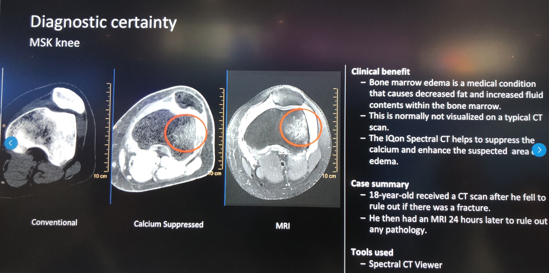 RSNA2018 Report (2) Philips MR / CT