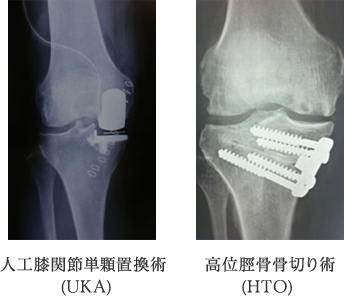 膝関節班｜臨床研究班｜整形外科学講座について｜東京慈恵会医科大学