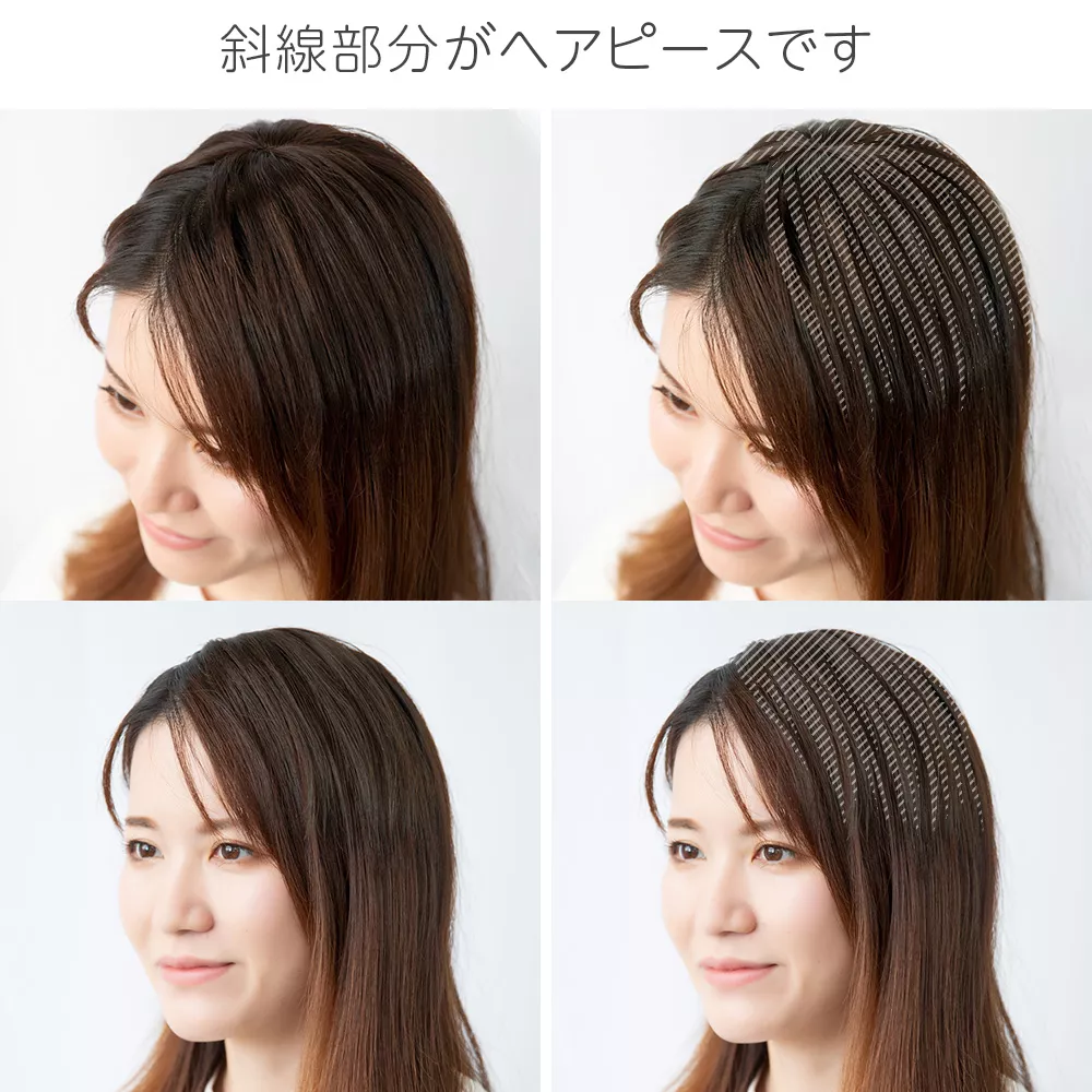 総手植え 人毛100%ワンタッチトップヘアピース（ポイント/医療用