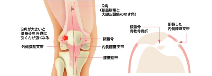 膝関節の疾患と手術：整形外科の専門手術 人工関節手術・関節鏡視下
