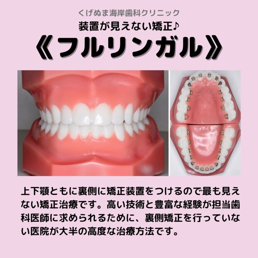 4EC6BF1A-9C06-4963-A735-