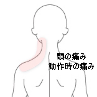 左回旋制限と頭痛を伴う寝違えの症状 | すのさき鍼灸整骨院 肩こり