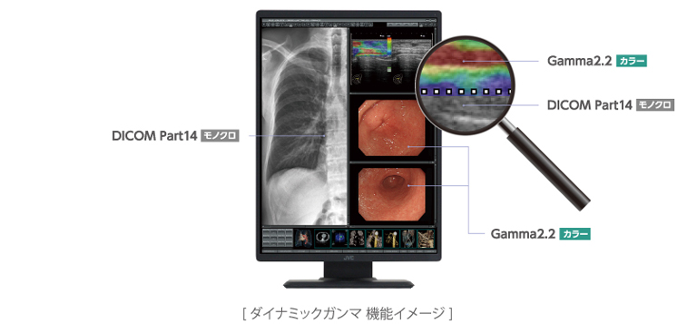 300万画素21.3型カラー液晶モニターCL-S301 | 医用モニター / 産業用
