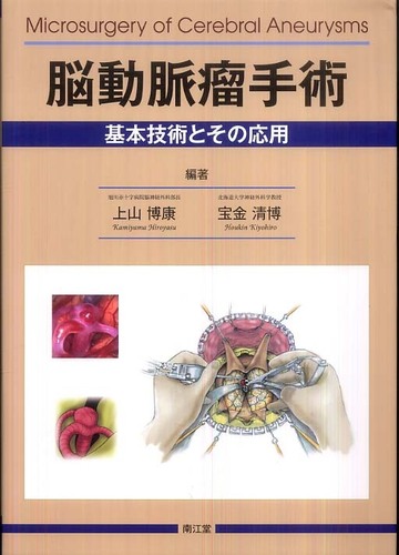 脳動脈瘤手術― 基本技術とその応用 - メディカルブックサービス online