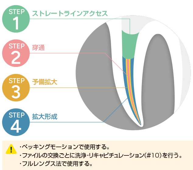 JIZAI製品情報 - JIZAI NiTi Rotary Files / MANI, INC.