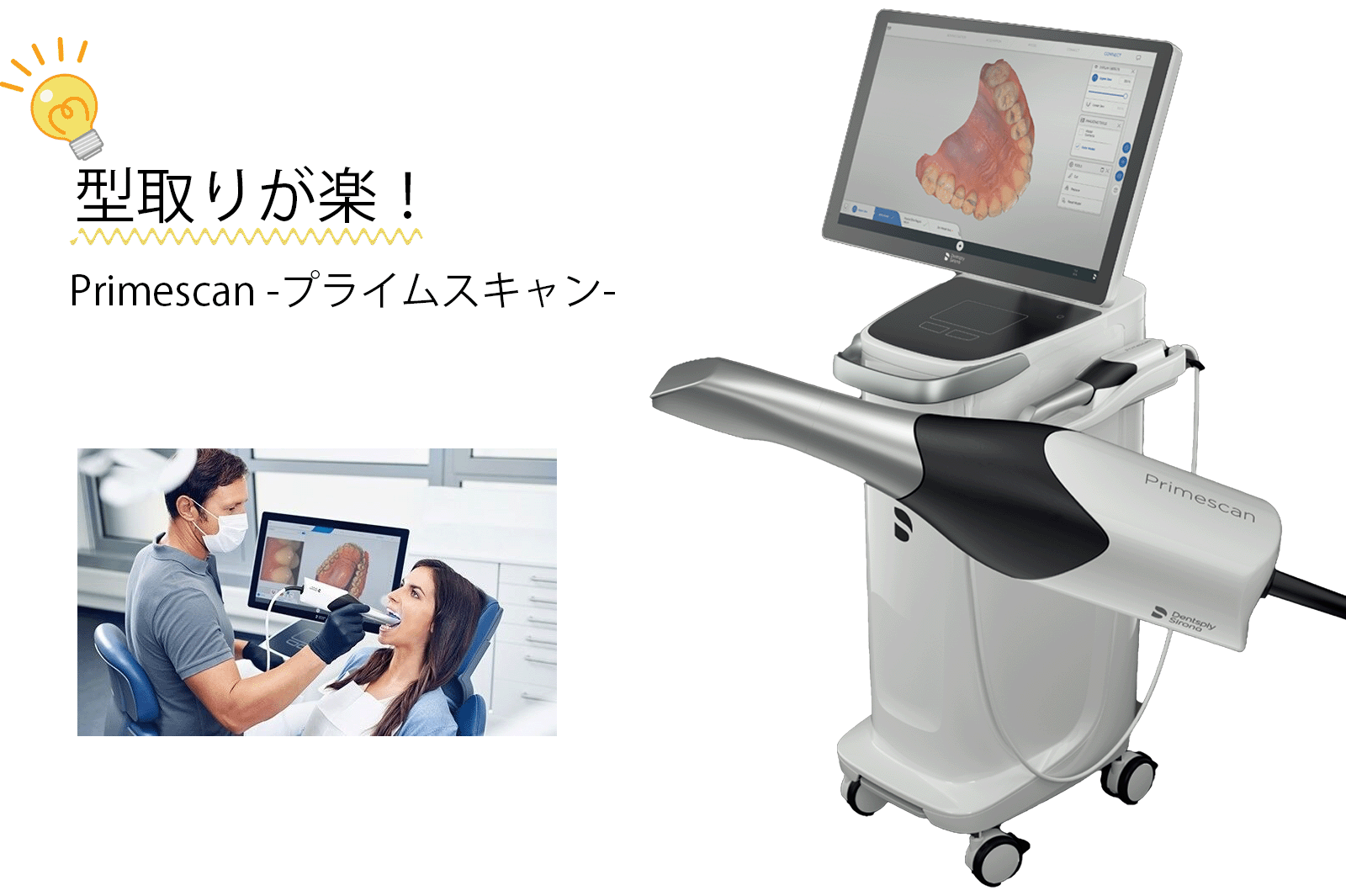 光学式口腔内スキャナー・Primescan｜中津まさデンタルクリニック
