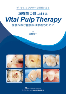 必ず上達 デジタル時代の歯冠修復 - クインテッセンス出版