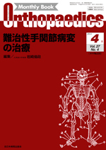 Monthly Book Orthopaedics（オルソペディクス） 27/4|全日本病院出版会
