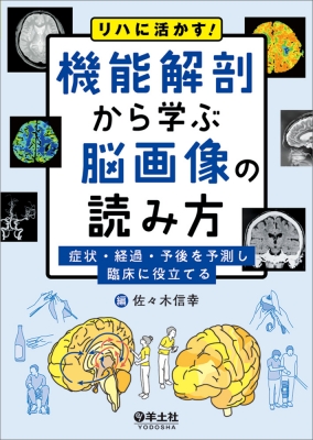 リハに活かす!機能解剖から学ぶ脳画像の読み方 : 佐々木信幸