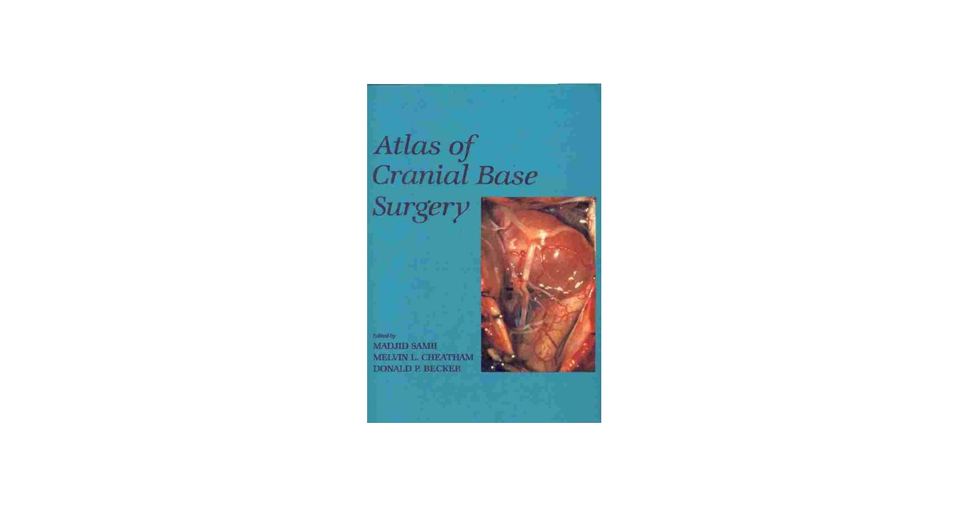 Atlas of Cranial Base Surgery: 9780721638829: Medicine & Health