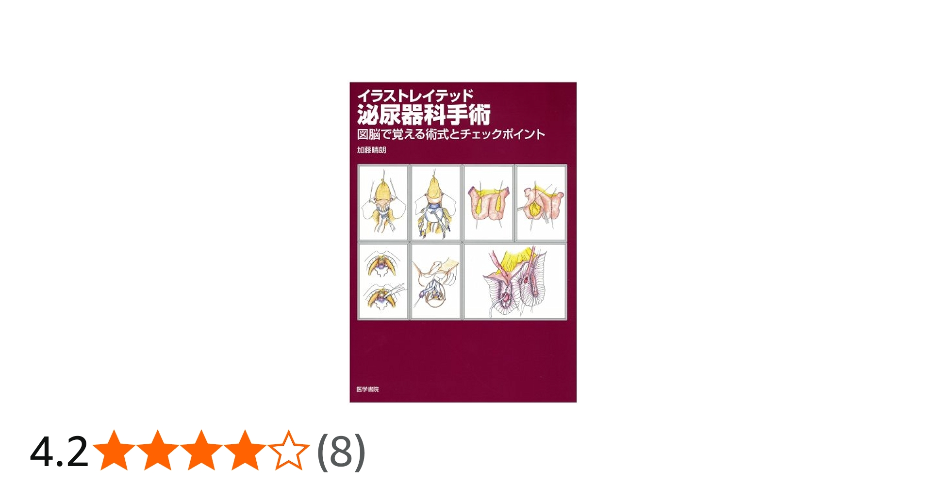 Amazon.co.jp: イラストレイテッド泌尿器科手術―図脳で覚える術式と