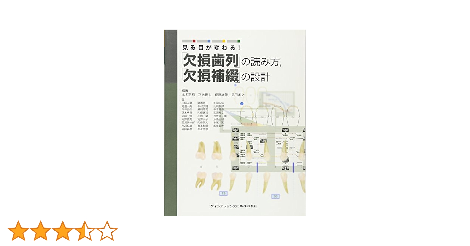 見る目が変わる!「欠損歯列」の読み方,「欠損補綴」の設計 楽天