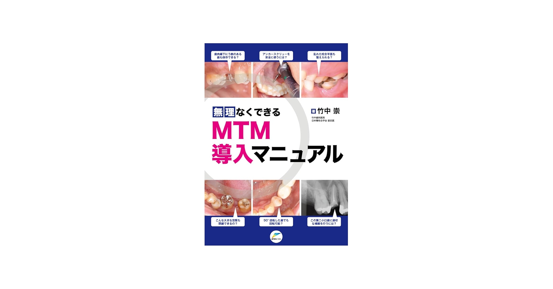 Amazon.co.jp: 無理なくできるMTM導入マニュアル : 竹中 崇: 本