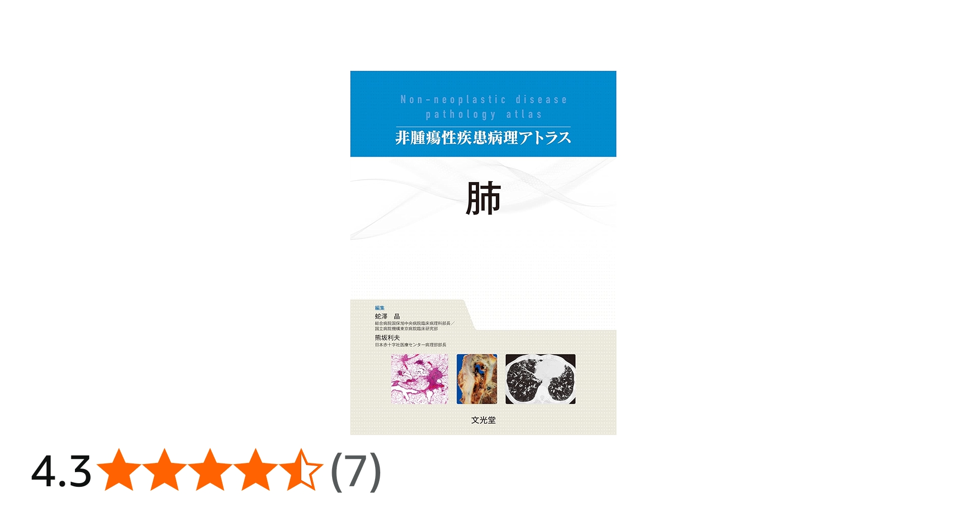 肺 (非腫瘍性疾患病理アトラス) | 蛇澤 晶, 熊坂利夫 |本 | 通販 | Amazon