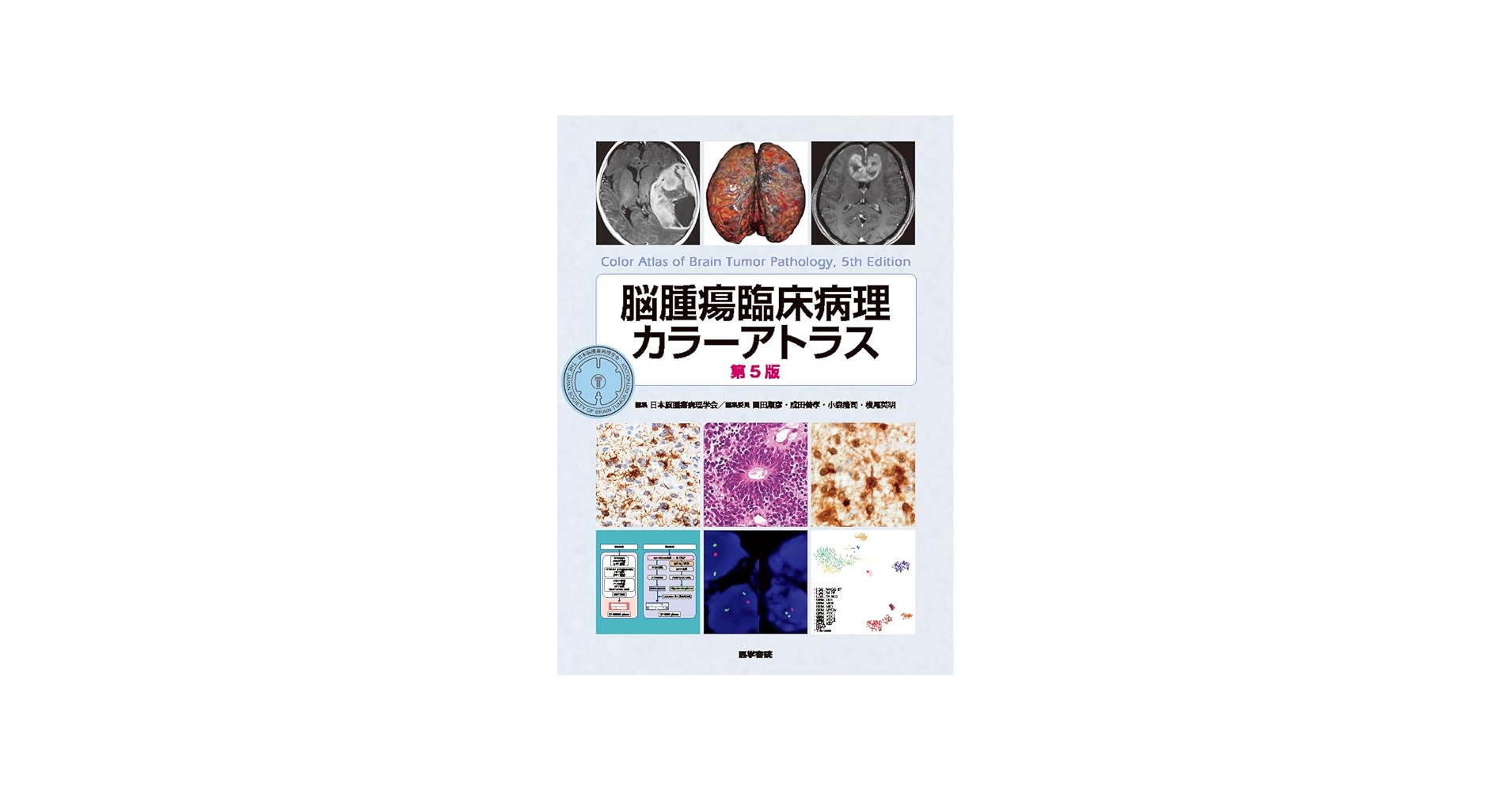 Amazon.co.jp: 脳腫瘍臨床病理カラーアトラス 第5版 : 日本脳腫瘍病理