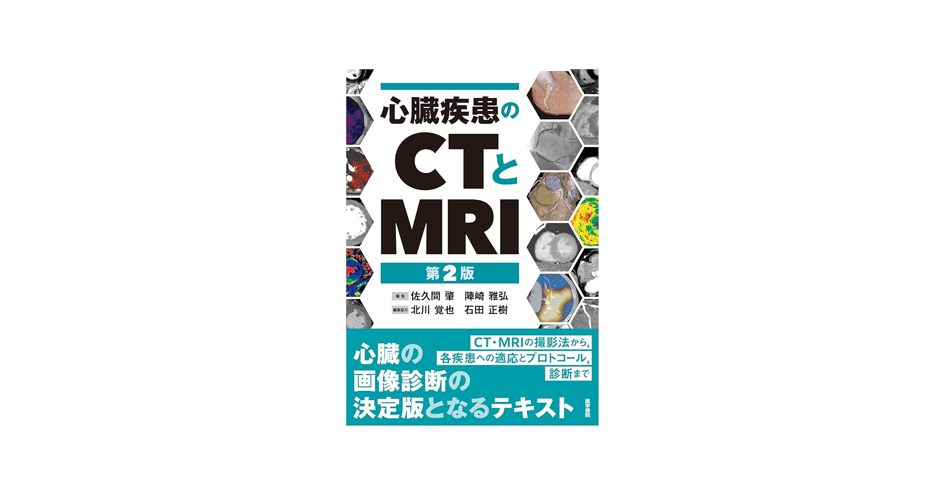 心臓疾患のCTとMRI 第2版 | 佐久間肇, 陣崎雅弘, 北川覚也, 石田正樹