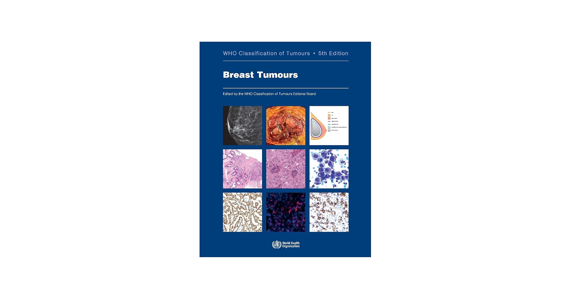 Breast Tumours: WHO Classification of Tumours (Medicine