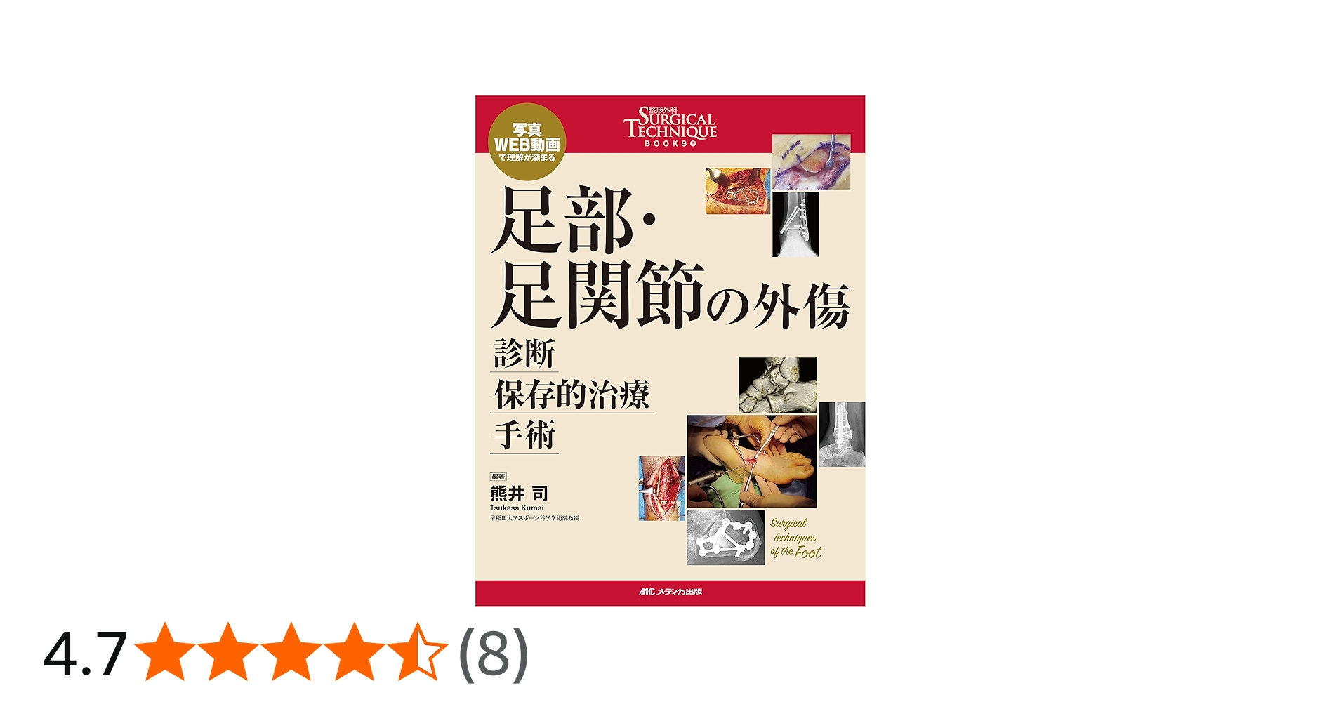 足部・足関節の外傷 診断・保存的治療・手術: 写真・WEB動画で理解が