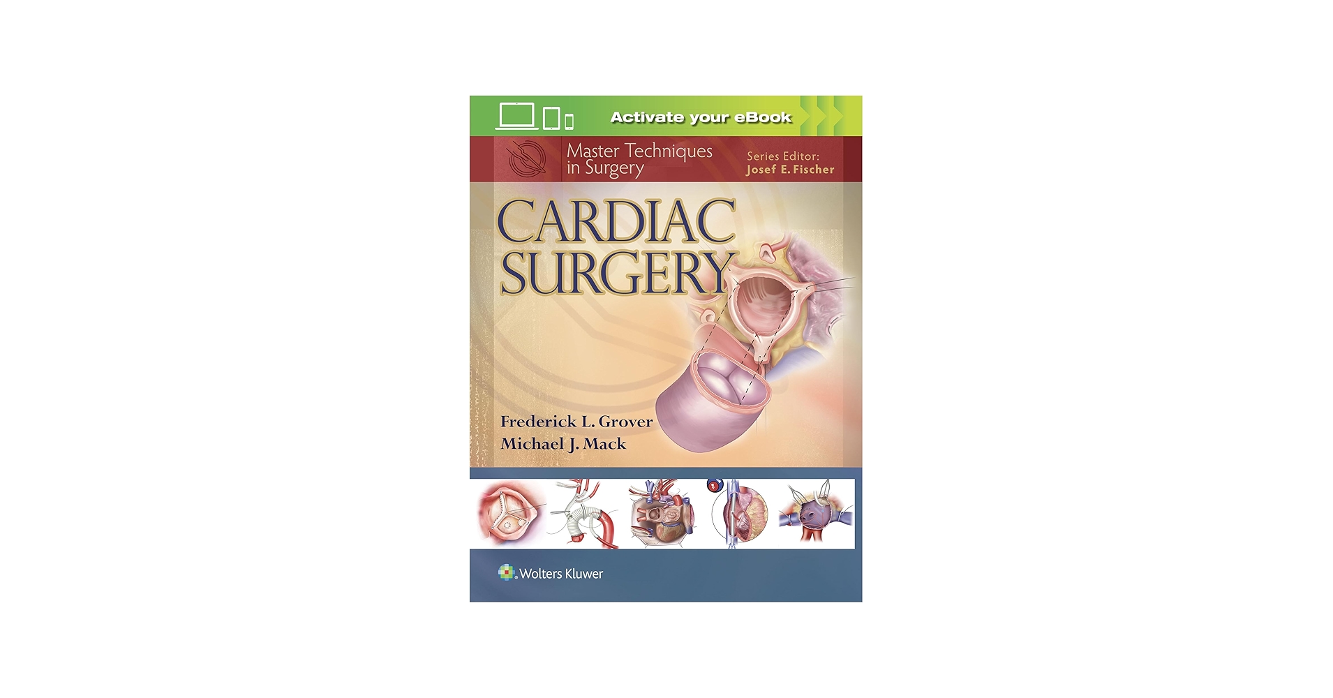 Cardiac Surgery (Master Techniques in Surgery): 9781451193534