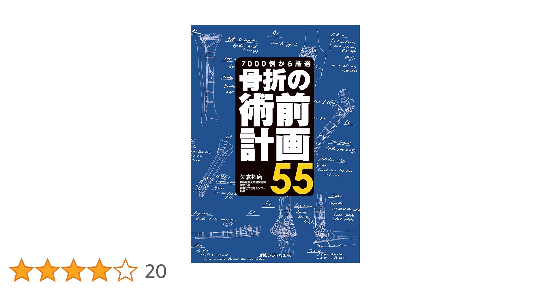 裁断済】骨折の術前計画 55 骨折の術前計画55: 7000例から厳選 | 矢倉