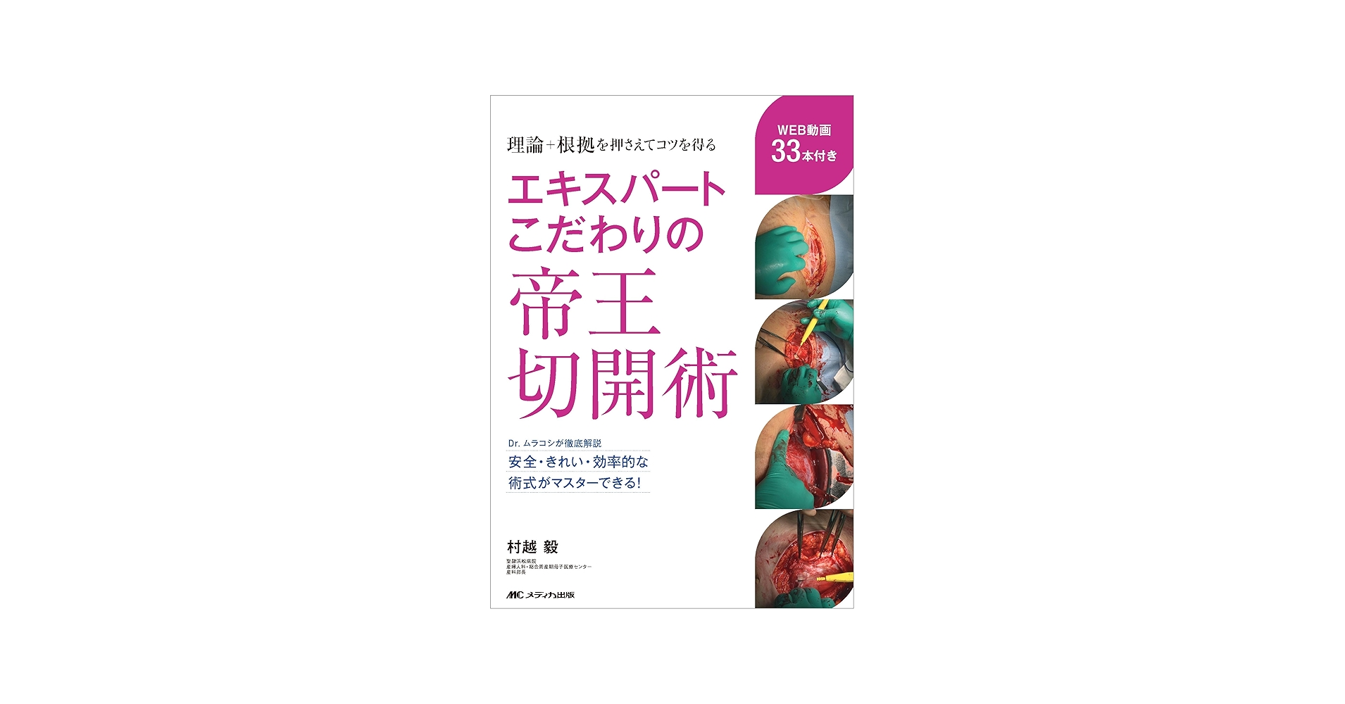 エキスパートこだわりの帝王切開術：理論＋根拠を押さえてコツを得る