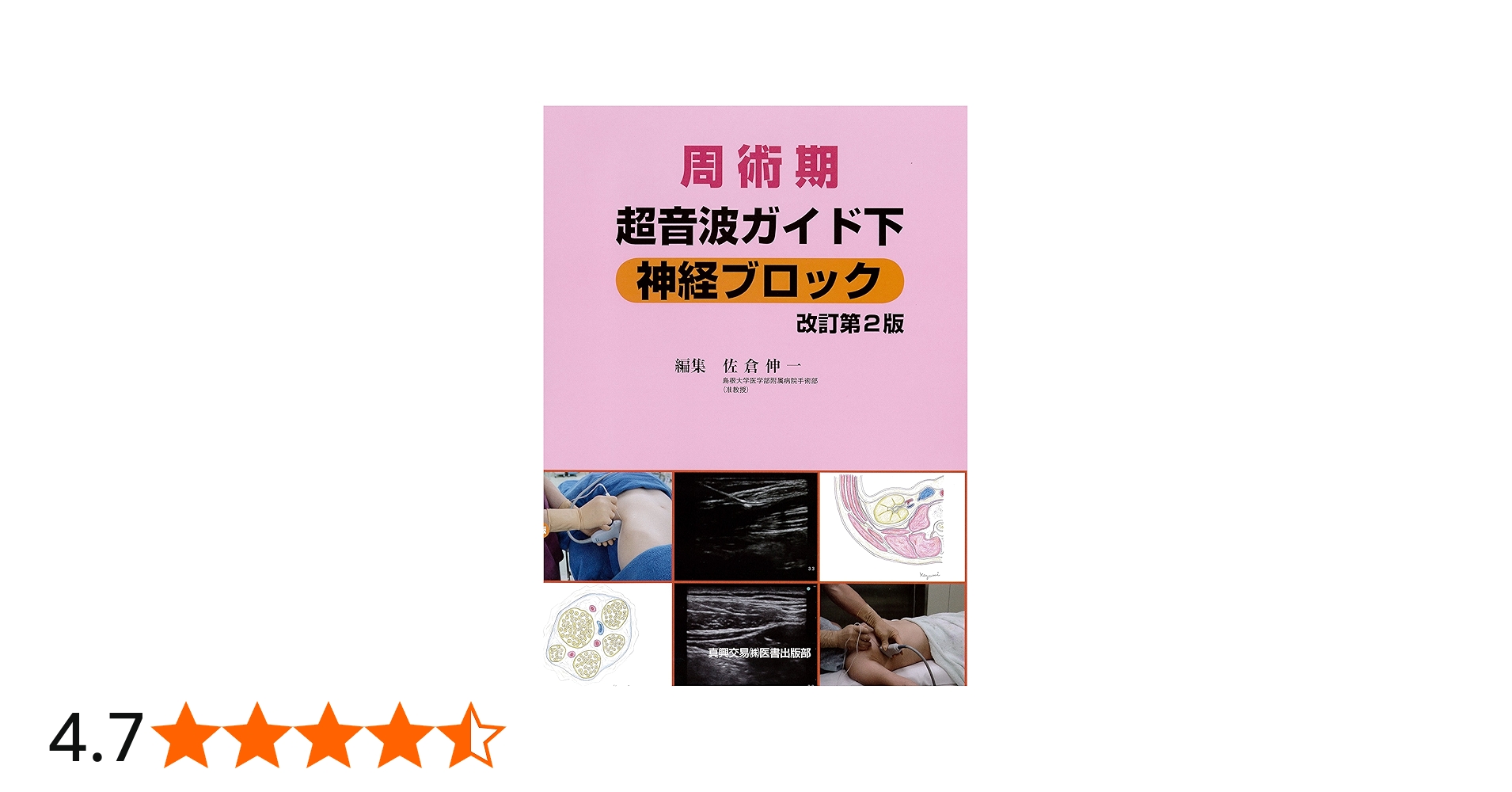 Amazon.co.jp: 周術期超音波ガイド下神経ブロック : 佐倉 伸一: 本
