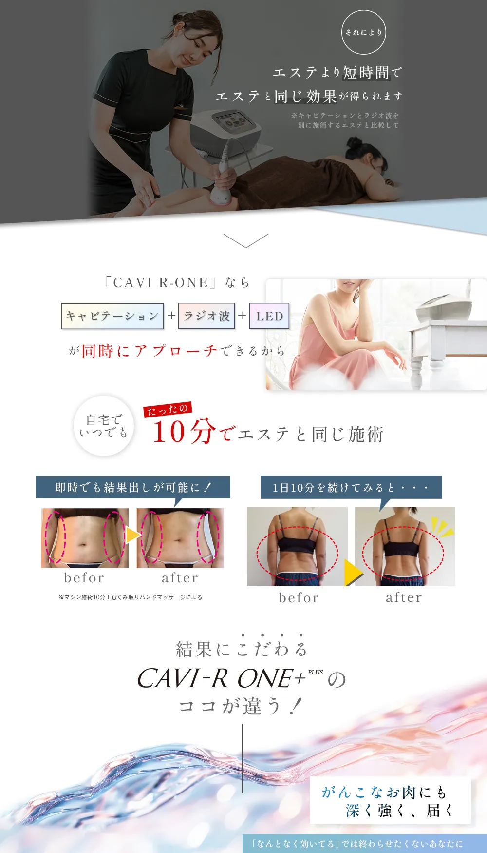 CAVI-R ONE＋|キャビテーション・ラジオ波・LEDでお腹・太ももを