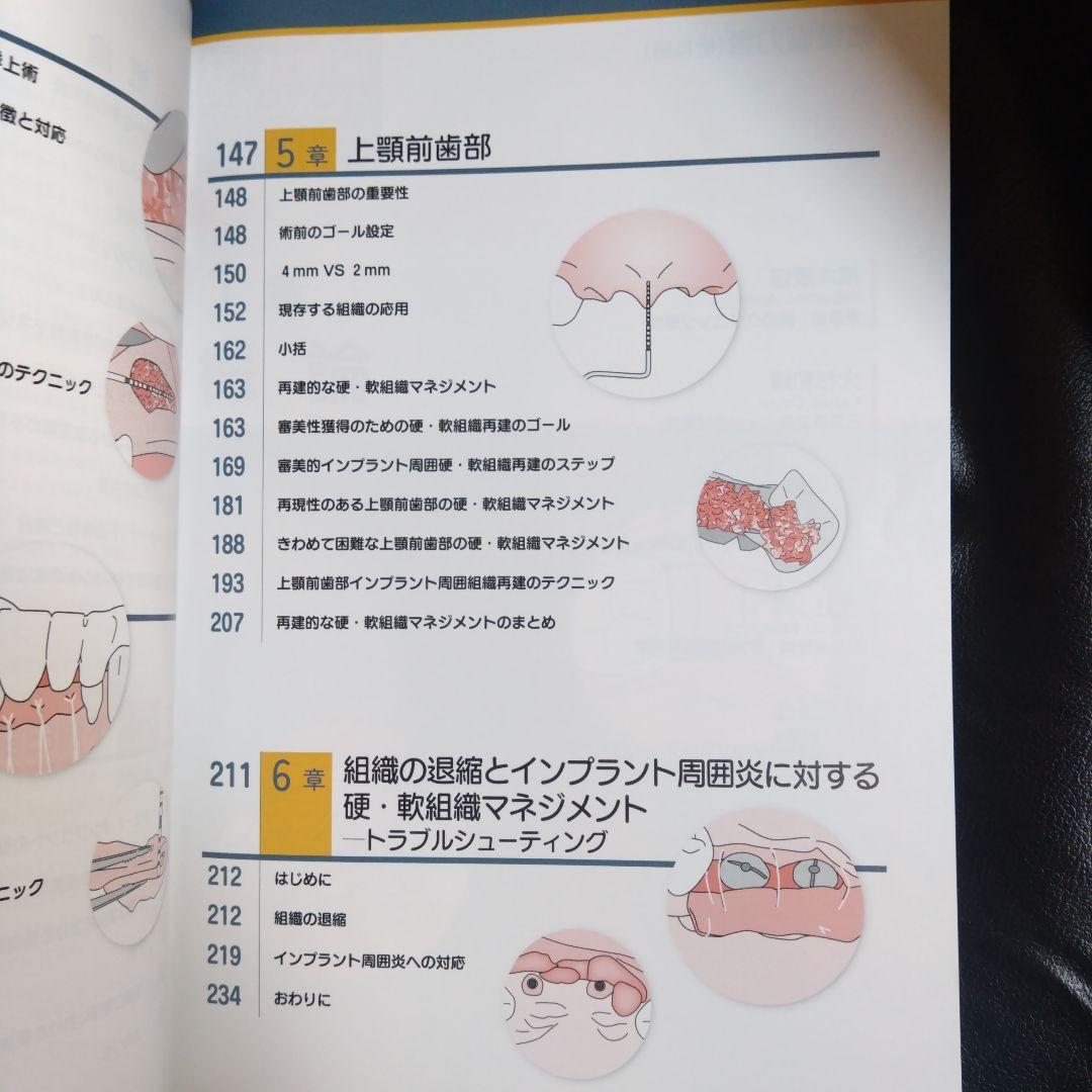 硬・軟組織マネジメント大全 インプラント 歯科 クインテッセンス出版