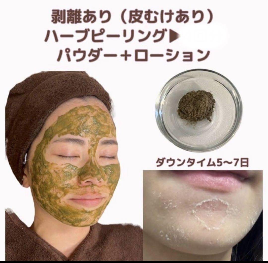 剥離ありハーブピーリング - メルカリ