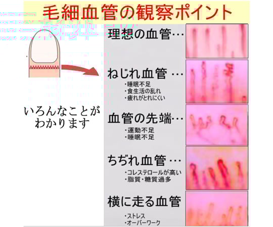 67-5519-48 血流スコープ 240倍 MJ-BL10 【AXEL】 アズワン