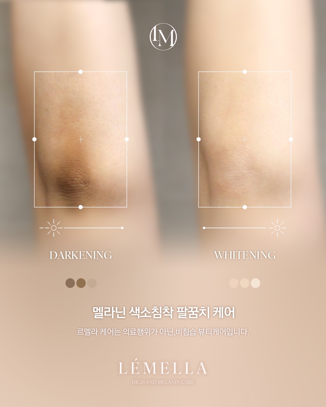 ルメラ ボディクリーム ハイエンドメラニンケア LÉMELLA ボディ