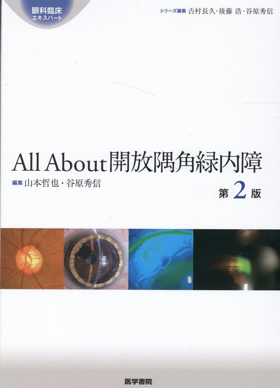 All About開放隅角緑内障 第2版 眼科臨床エキスパート/山本哲也